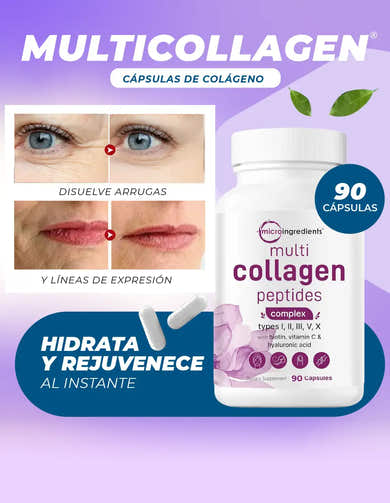 Imagen del carrusel