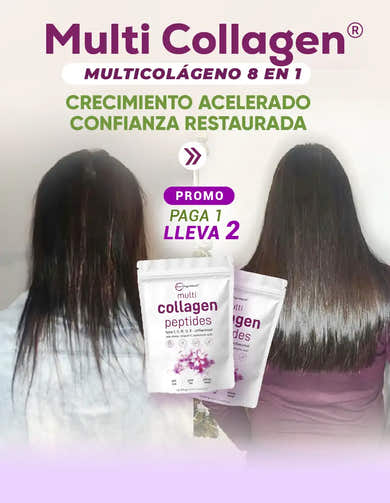 Imagen del carrusel