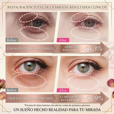 Imagen del carrusel