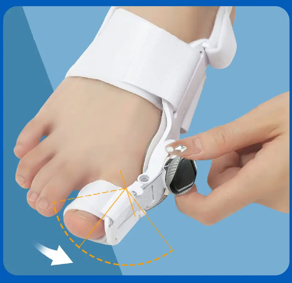 CORRECTOR DE JUANETES [PV1-WHATSAPP-OFERTASIMPLETOP]