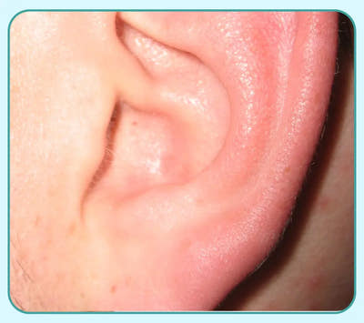 After Image