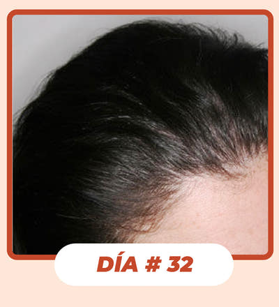 After Image