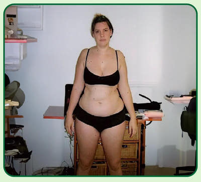 Before Image
