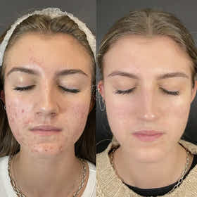 ss-testimonial-25__media_review_4_image_c6d8e7.webp